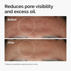 THE ORDINARY Niacinamide 10% + Zinc 1% : Sérum Visage |  60 ml
