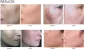 MCCM Melano Out Cream: Depigmenting Treatment for Reducing Dark Spots and Hyperpigmentation | 30ml MCCM Melano Out Cream: Depigmenting Treatment for Reducing Dark Spots and Hyperpigmentation | 30ml