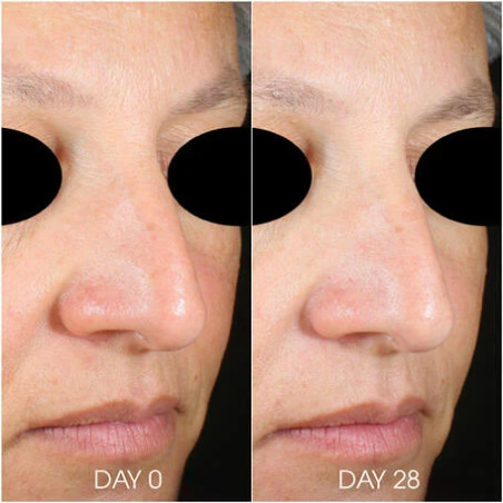 TEOXANE RHA HYDRA MASK Masque ultra hydratant et repulpant | Tube de 50ml