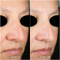 TEOXANE RHA HYDRA MASK Masque ultra hydratant et repulpant | Tube de 50ml